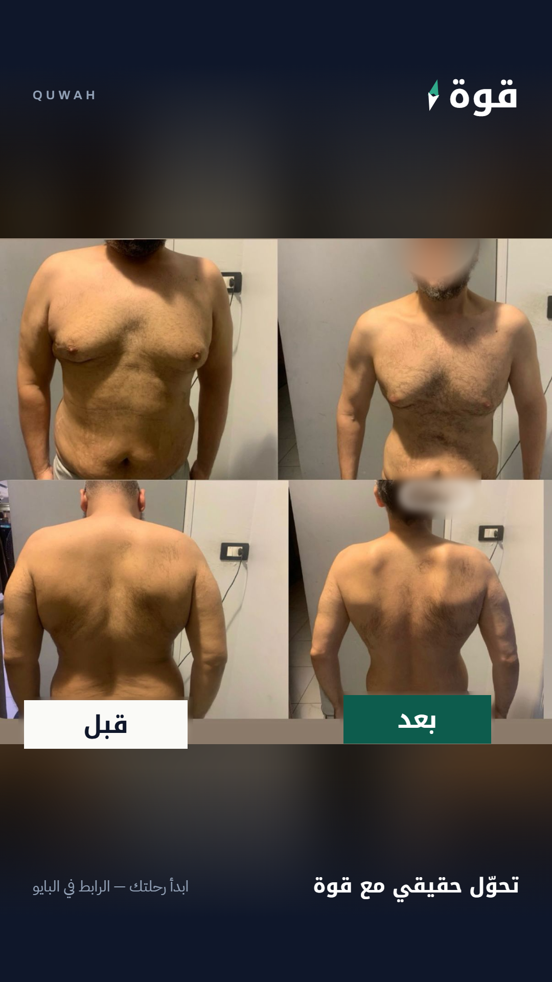 قصة نجاح - خسارة دهون وإعادة تشكيل الجسم